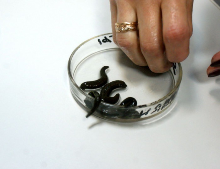 Гирудотерапия - Санаторий «Белая Русь» Беларусь